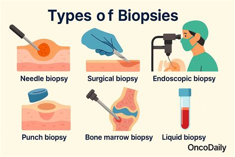 Why Is Biopsy Dangerous