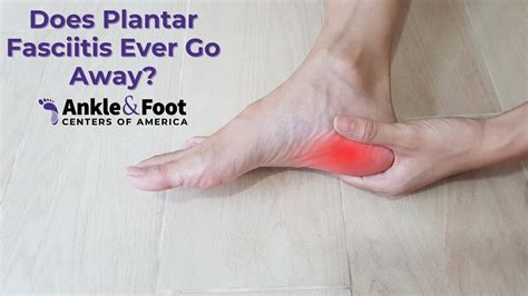 Will Plantar Fasciitis Go Away