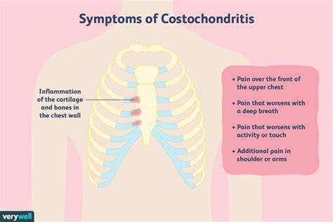 Woman Costochondritis Pain Areas