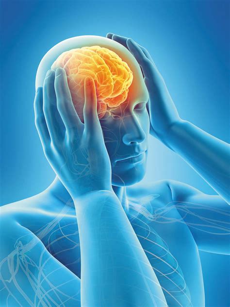 Worst Headache Of My Life