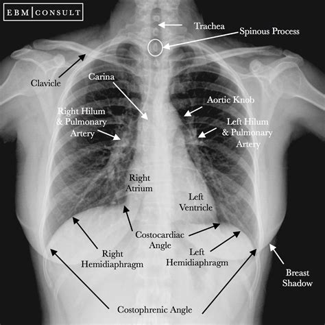 Xray Anatomy