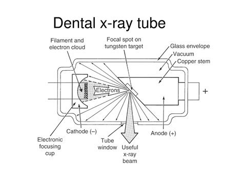 Xray Tube Diagram Labeled