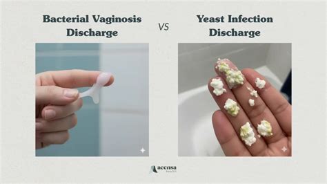Yeast Infection Or Bv