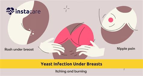 Yeast Under Breast